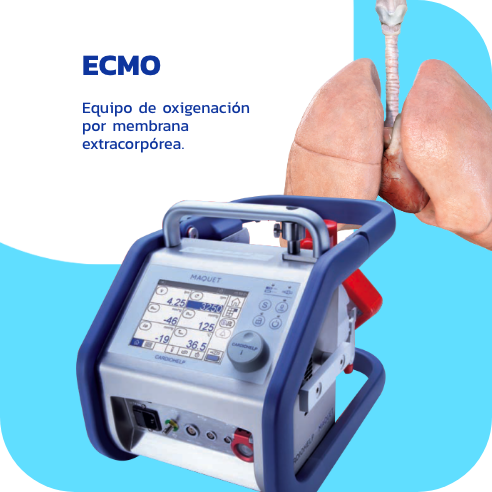 ECMO - Equipo de oxigenación por membrana extracorpórea